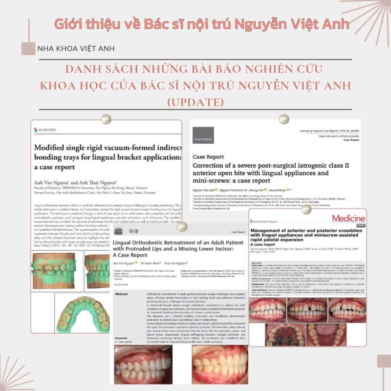 Giới thiệu về Bác sĩ nội trú Nguyễn Việt Anh – Chuyên gia Chỉnh nha