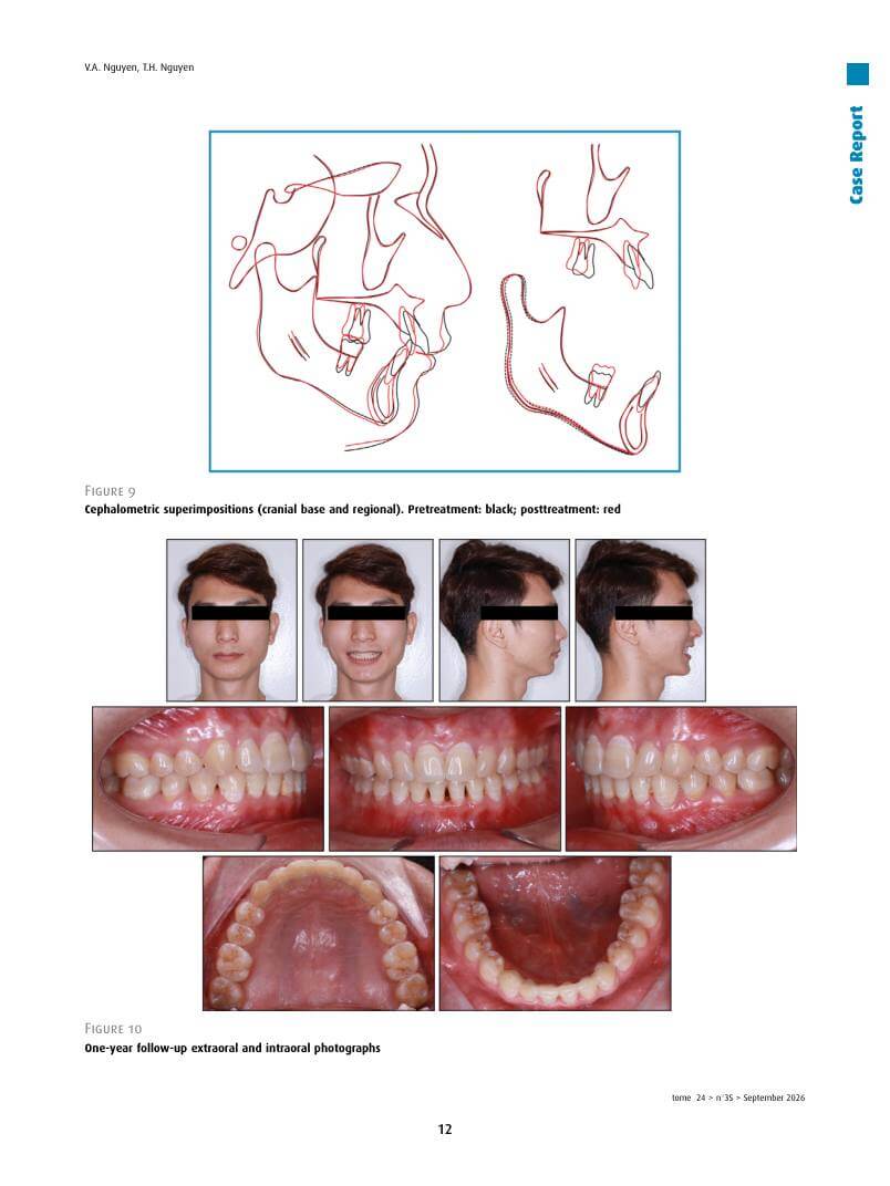 Hình 3. Trang tiêu biểu (trang 12 của PDF) được trích từ bài báo gốc để người đọc đối chiếu.
