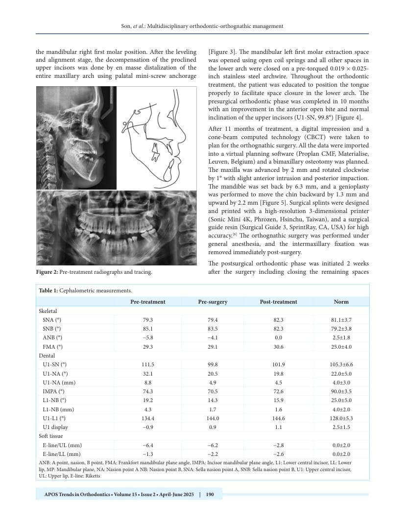 Hình 2. Trang tiêu biểu (trang 3 của PDF) được trích từ bài báo gốc để người đọc đối chiếu.