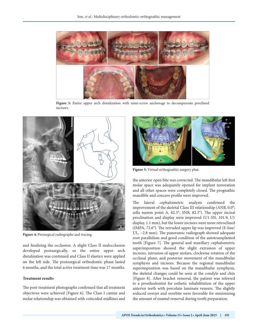 Hình 3. Trang tiêu biểu (trang 4 của PDF) được trích từ bài báo gốc để người đọc đối chiếu.