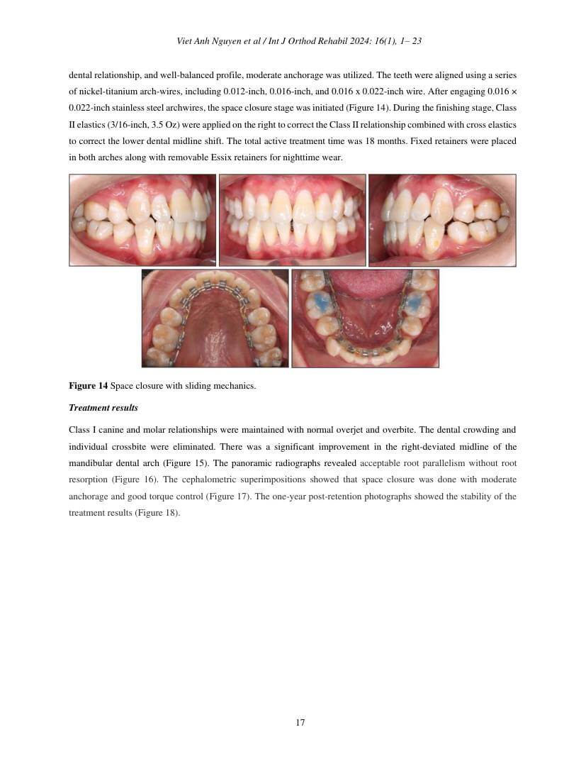 Hình 3. Trang tiêu biểu (trang 17 của PDF) được trích từ bài báo gốc để người đọc đối chiếu.