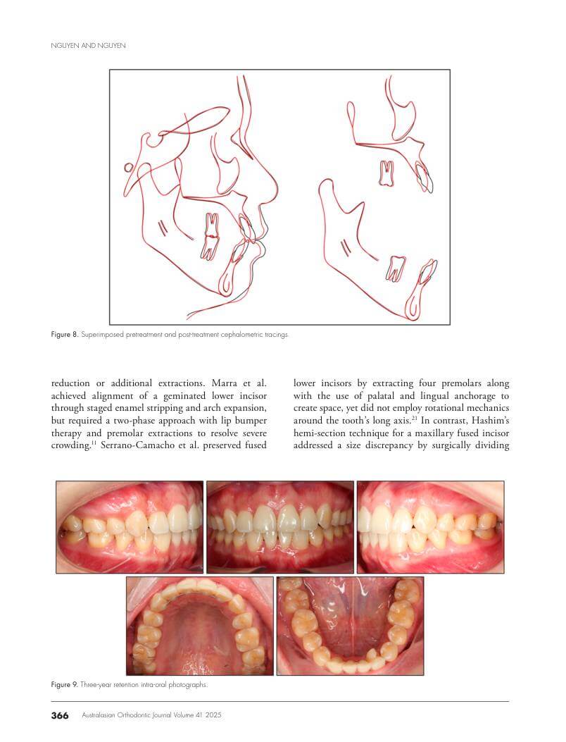 Hình 3. Trang tiêu biểu (trang 10 của PDF) được trích từ bài báo gốc để người đọc đối chiếu.
