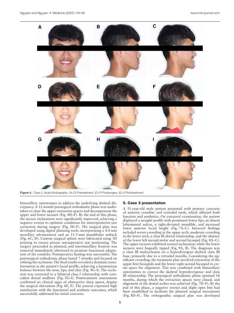 Hình 3. Trang tiêu biểu (trang 5 của PDF) được trích từ bài báo gốc để người đọc đối chiếu.